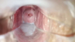 Cum inside pussy close-up speculum